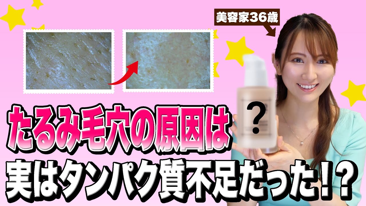 ☆シャンソン化粧品☆たるみ・毛穴コース せまかっ