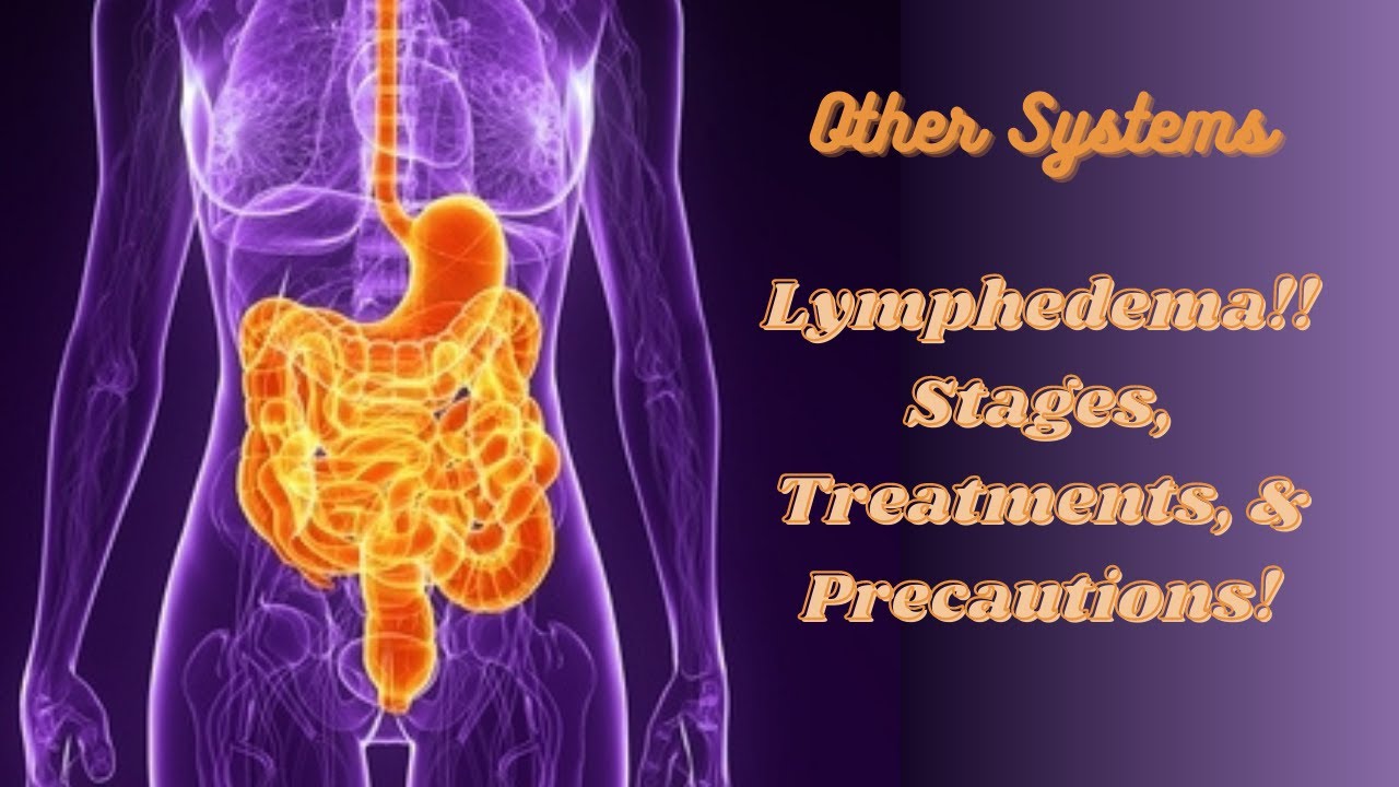 NPTE Staging & Treatment of Lymphedema with Practice QUESTIONS! - YouTube