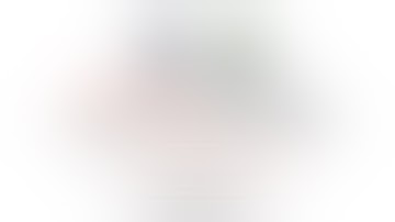 Left trisectionectomy with Hilar and Caudate lobe resection for pCCA; Using Pure-electrocautery tech