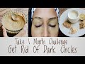Get Rid Of Dark Circles Using 100% Natural Eye Pack | 1 Month Challenge - Results Gauranteed