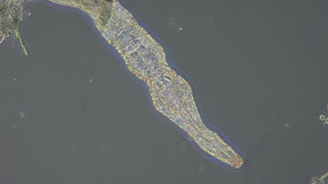 BS 2093A Inverted Biological Microscope Phase Contrast Sample Video