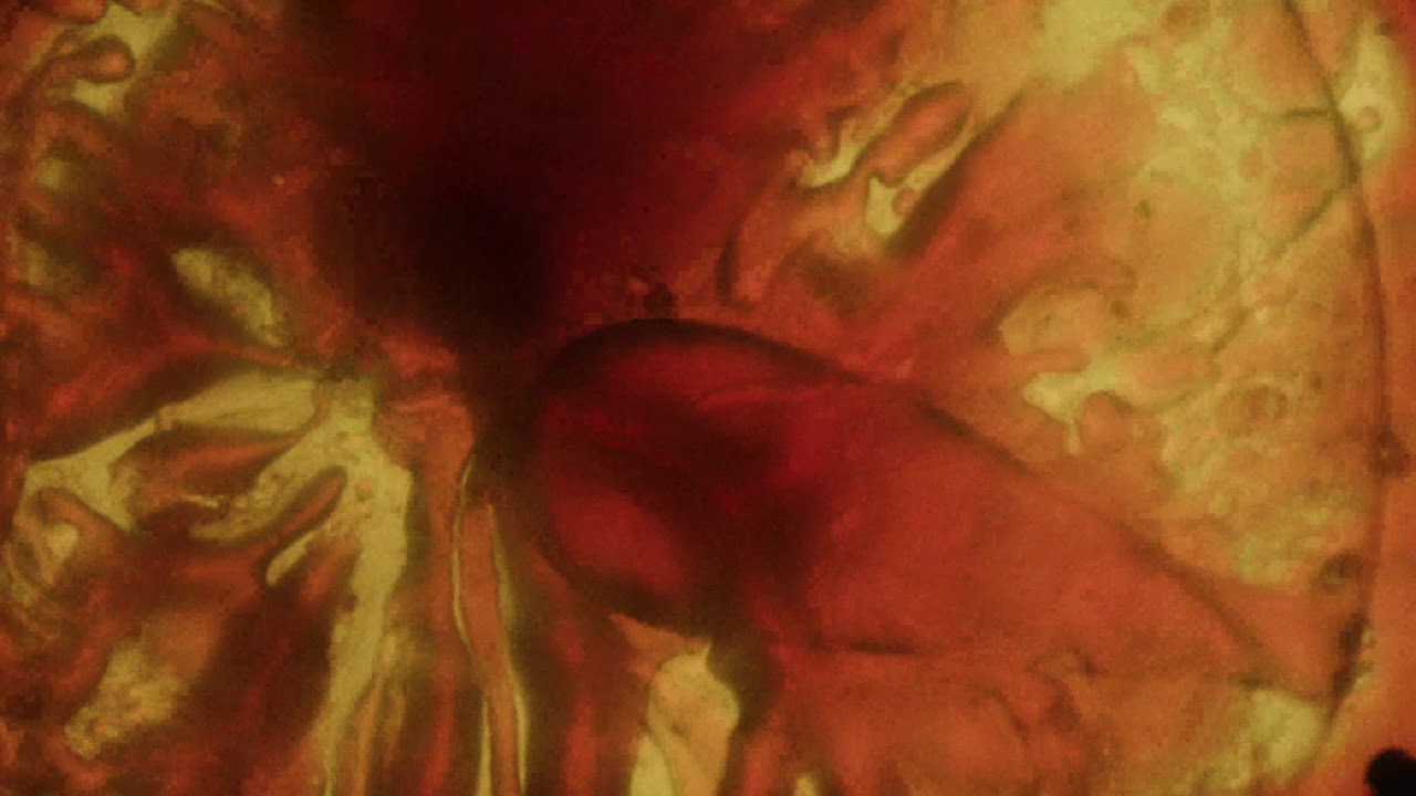 Illiterate Light - Existential Crisis [Official Audio]