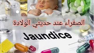 تحليل الصفراء عند الاطفال حديثي الولاده انواعه واسبابه وعلاجه Jaundice/ نسبه الصفراء الطبيعيه