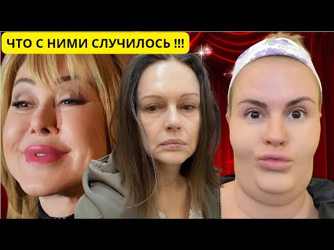 ИСПОРТИЛИ СЕБЯ: 7 Звёзд, Чьи Новые Образы Шокировали Поклонников