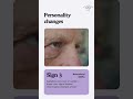 4 Signs Your Parent Needs Specialized Dementia Care at Home