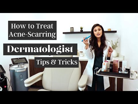 Derm Shares Acne-Scarring Tips & Tricks | Dr. Sheila Derm