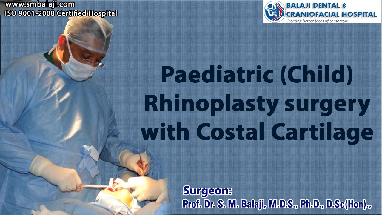 Paediatric (Child) Rhinoplasty Surgery with Costal Cartilage - YouTube