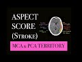 Aspect score for stroke  mca  pca infarct