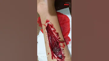 طريقة عمل جرح مزيف في خطوات بسيطه 