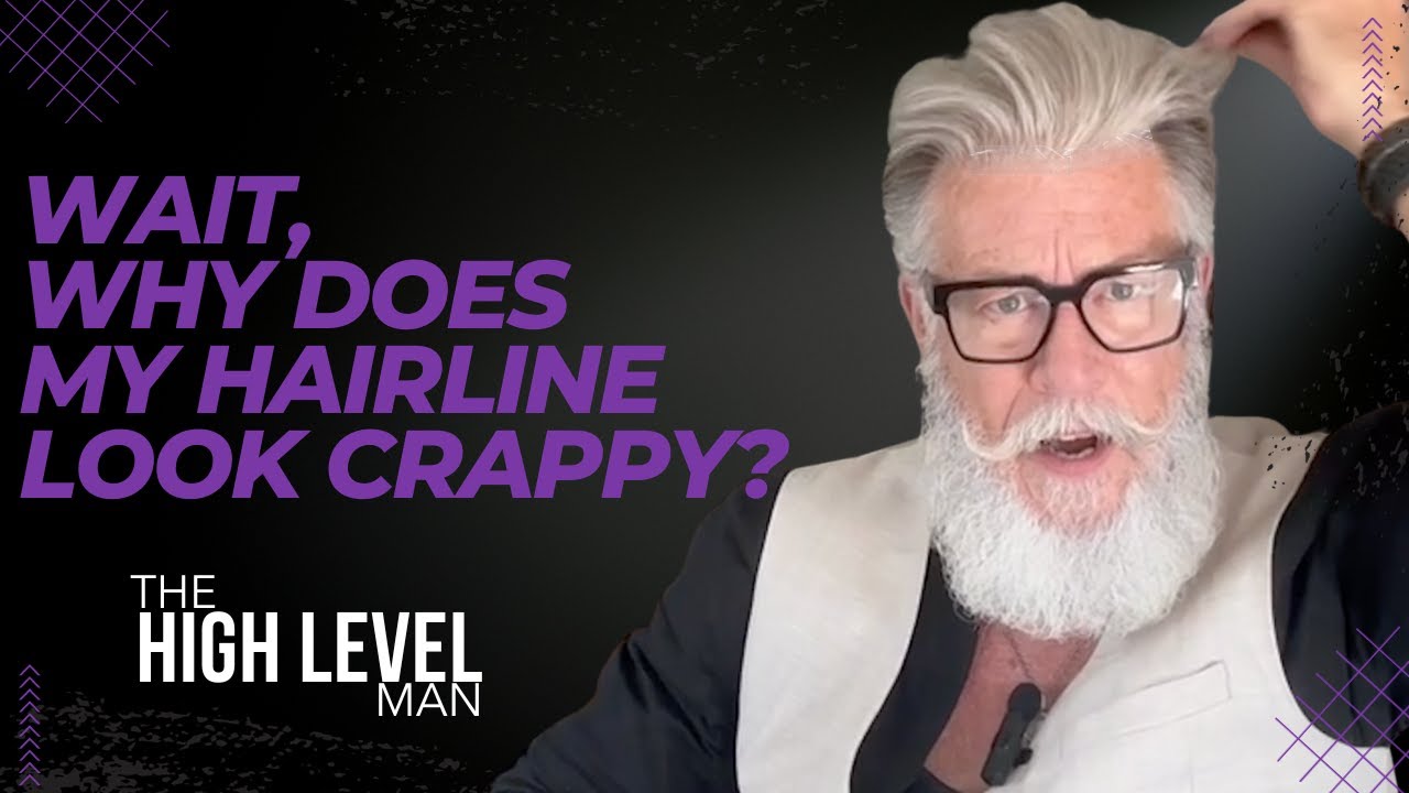 Wait, Why Does My Hairline Look Crappy? | A Product Solution To Hair Systems