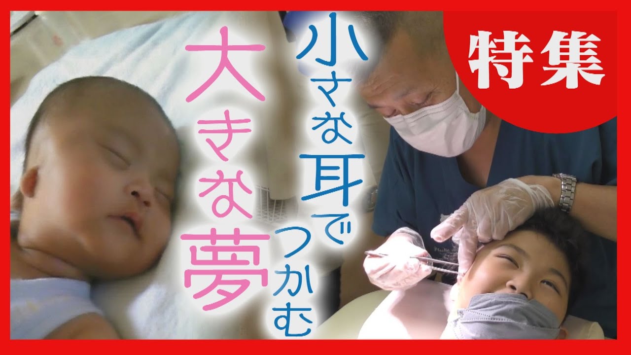【名医が執刀】生まれつき耳が小さい「小耳症」　新しい耳ができた！医師と男の子の記録