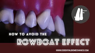 How to avoid the rowboat effect | Essential Biomechanics