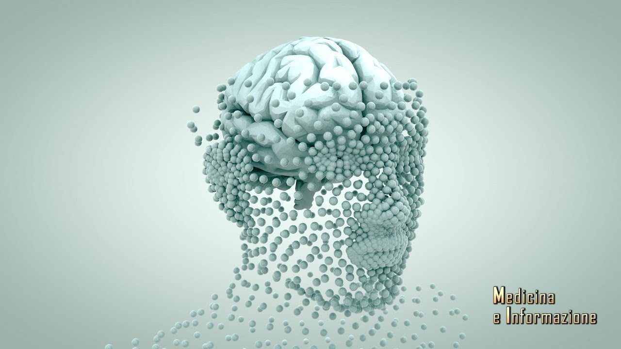 Emicrania Cronica: i nuovi anticorpi monoclonali per ridurre le crisi