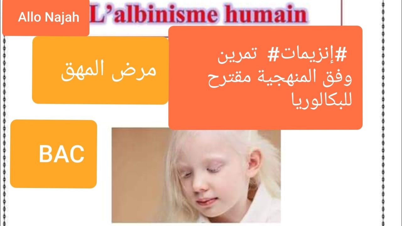 تمرين إنزيمات وفق المنهجيةمقترح للبكالوريا مرض المهق أو الإغراب.