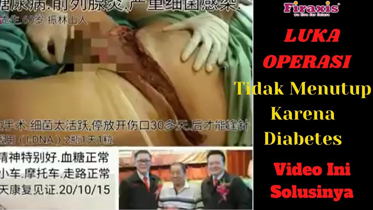 Faktorfaktor Yang Mempengaruhi Lama Penyembuhan Luka Pada