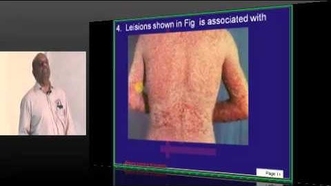 NEETPG Coaching Image Based MCQ