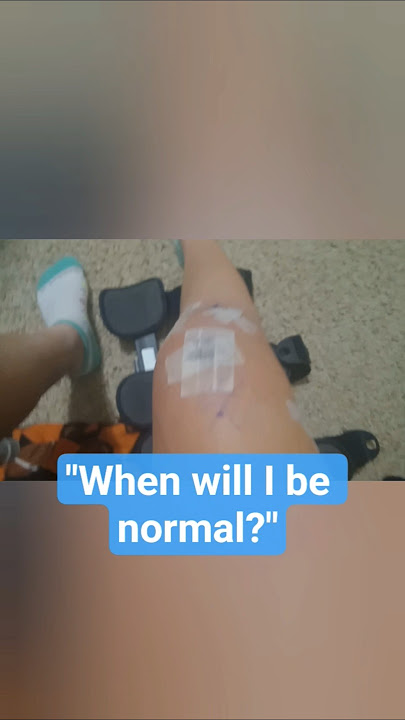The Untold Struggles of ACL Recovery