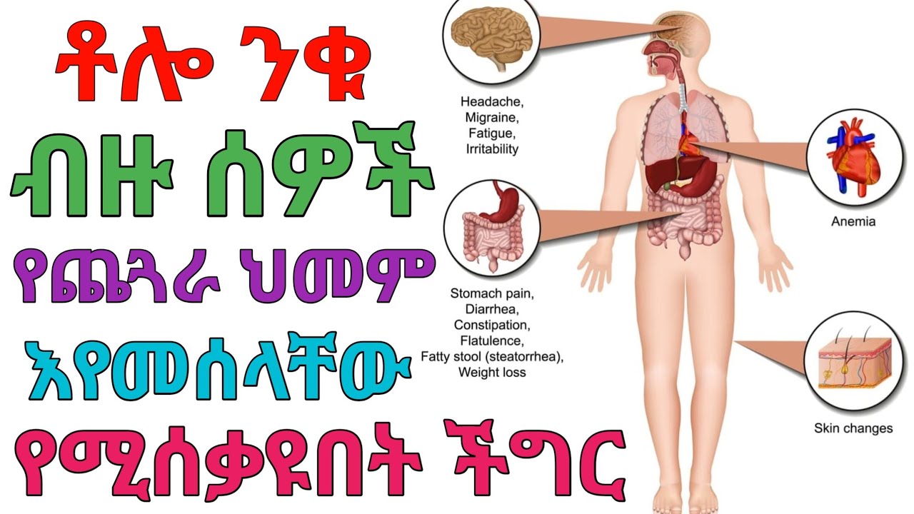 ጨጓራ አይደለም ቶሎ ንቁ | dryonas