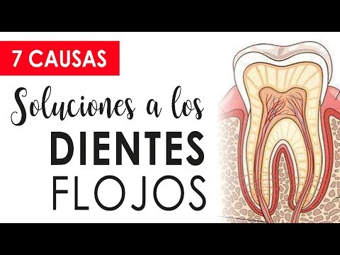 Vídeo: Diente Flojo: Dolor, Adultos Y Tratamiento