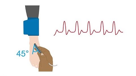Performing a manual ankle-brachial index (ABI)