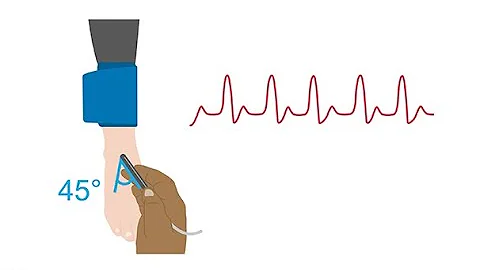 Performing a manual ankle-brachial index (ABI)