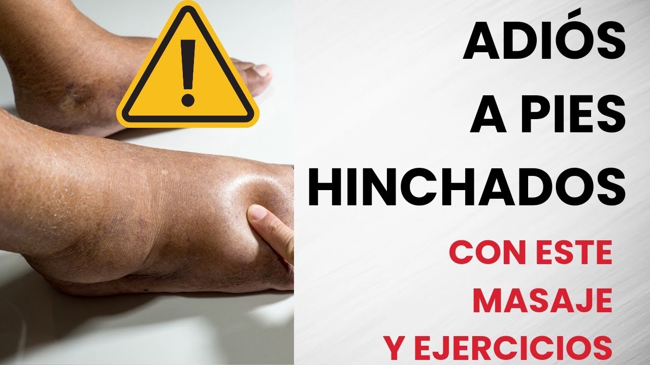 ✅NO MÁS PIES HINCHADOS, CON LÍQUIDO Y FRÍOS HACIENDO ESTE MASAJE Y EJERCICIOS