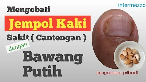 Mengobati Jempol Kaki Cantengan dengan Bawang Putih