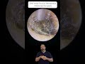 PERFECT EAR WAX PLUGS REMOVED