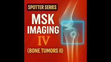 Spotter Series: MSK Imaging-IV (Bone tumors II)
