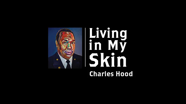 Living in My Skin: Charles Hood