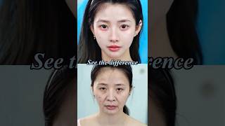 Quiet improvements often look the most real. #FacialRejuvenation #aestheticsurgery