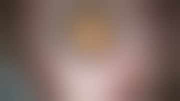 Retinal Procedure teaching video RESIGHT_Modul02