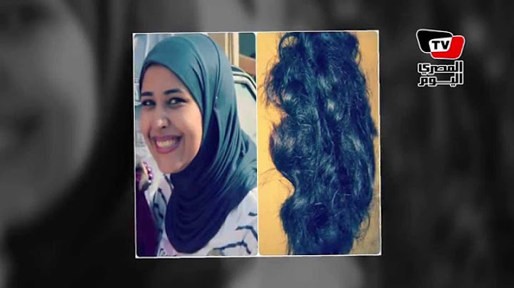"أماني" تخلت عن تاجها لمرضى السرطان