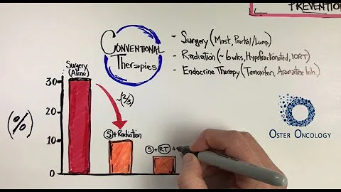 Breast Cancer Recurrence Prevention - An Illustrative Tutorial from Oster Oncology - DayDayNews