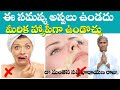 Simple Ways to Get Rid of Facial Hair Naturally | ఇక ఈ సమస్య ఉండదు | Dr Manthena Satyanarayana Raju
