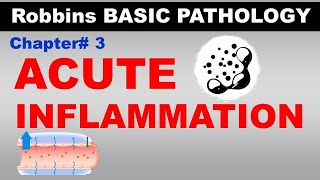 Chp3 (Part2) Robbins Basic Patho | ACUTE INFLAMMATION | Dr Asif Lectures