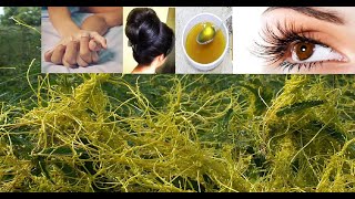 amarbel ke Anmol fayde || amazing benefits of amar bel || herbal vlogs