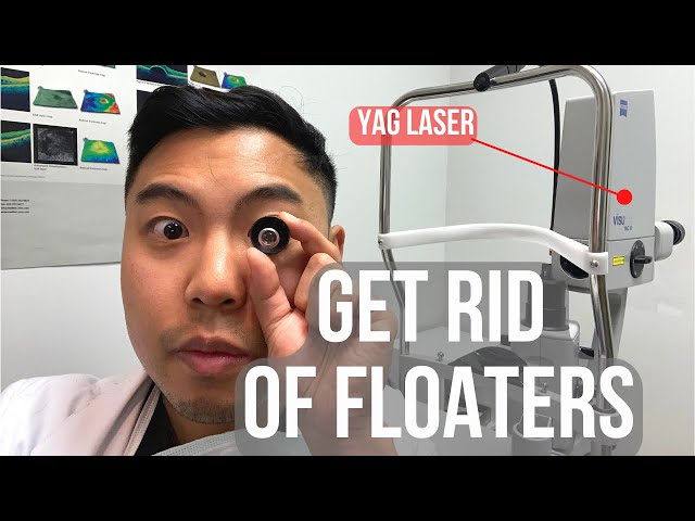 How to get rid of floaters in 2 MINUTES. (BUT IS IT SAFE?)