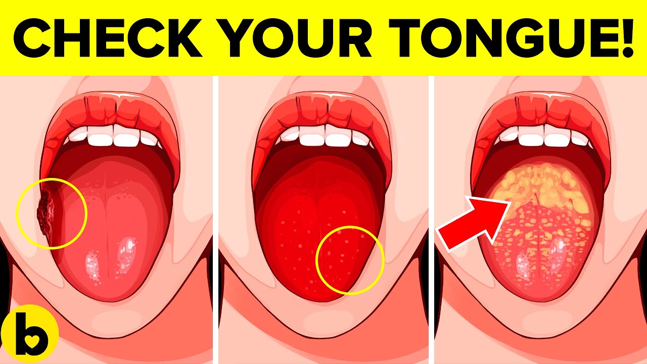 What Your Tongue Says About Your Health