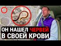 ЗОЖник нашел глистов в своей крови и был в ШОКе! Как нужно изгонять паразитов из своего организма?