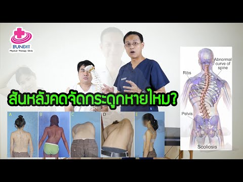 จัดกระดูกสันหลังแก้อาการกระดูกสันหลังคดได้จริงหรือไม่ | ตอบคำถามกับบัณฑิต EP.44