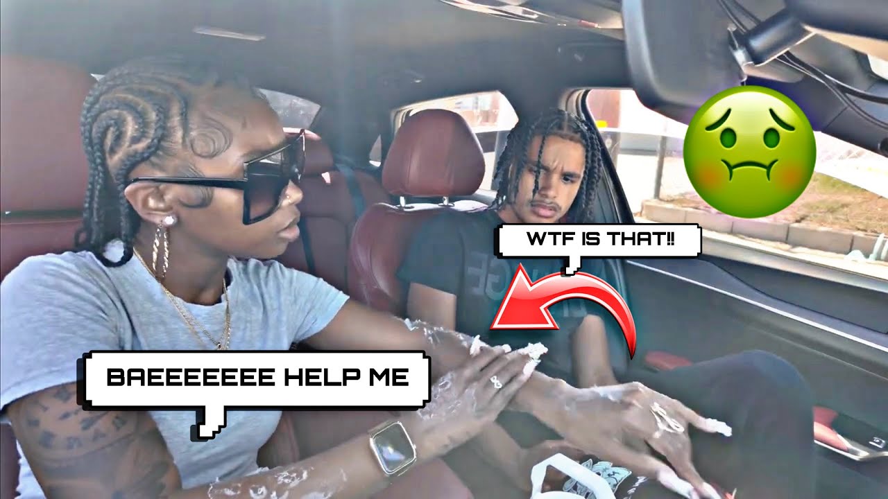 MY SKIN IS PEELING PRANK ON BOYFRIEND *he was disgusted* 🤢