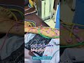Leg Pain & Nerve Weakness – Electrotherapy Treatment