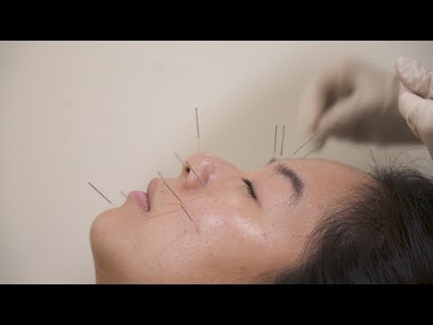 Video: Rawatan Akupunktur