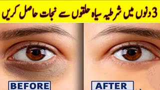 Diy dark circles removal || how to get rid of Dark circles at home