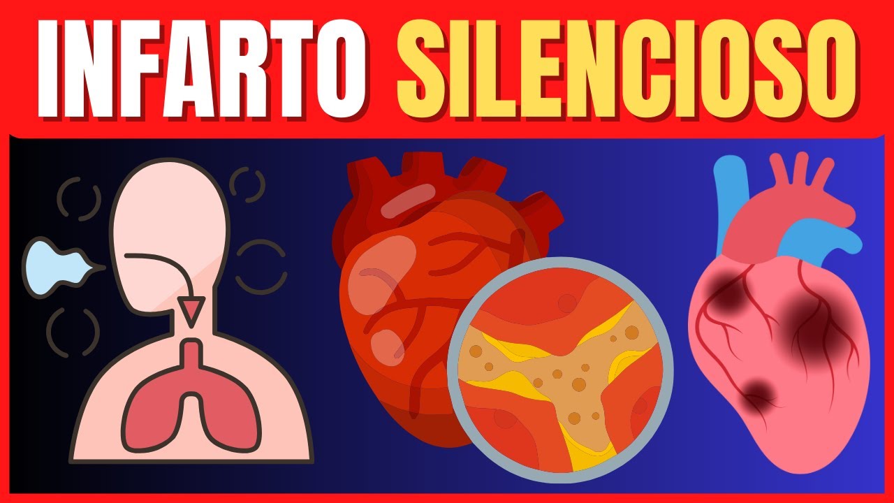 INFARTO SILENCIOSO SEM DOR NO PEITO | COMO RECONHECER UM ATAQUE ...
