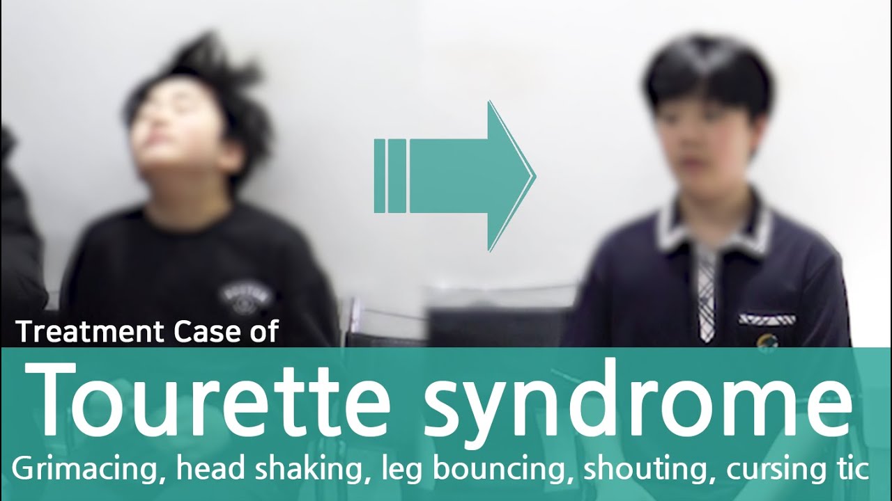 Tourette's Syndrome / Tic Disorder / 틱 뚜렛 장애 치료사례