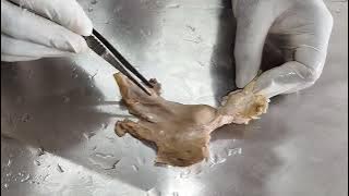 Uterus, Fallopian tube and Ovary Demo