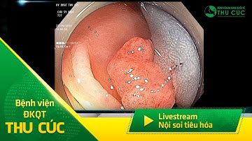 Làm sao để cắt polyp trong quá trình nội soi?