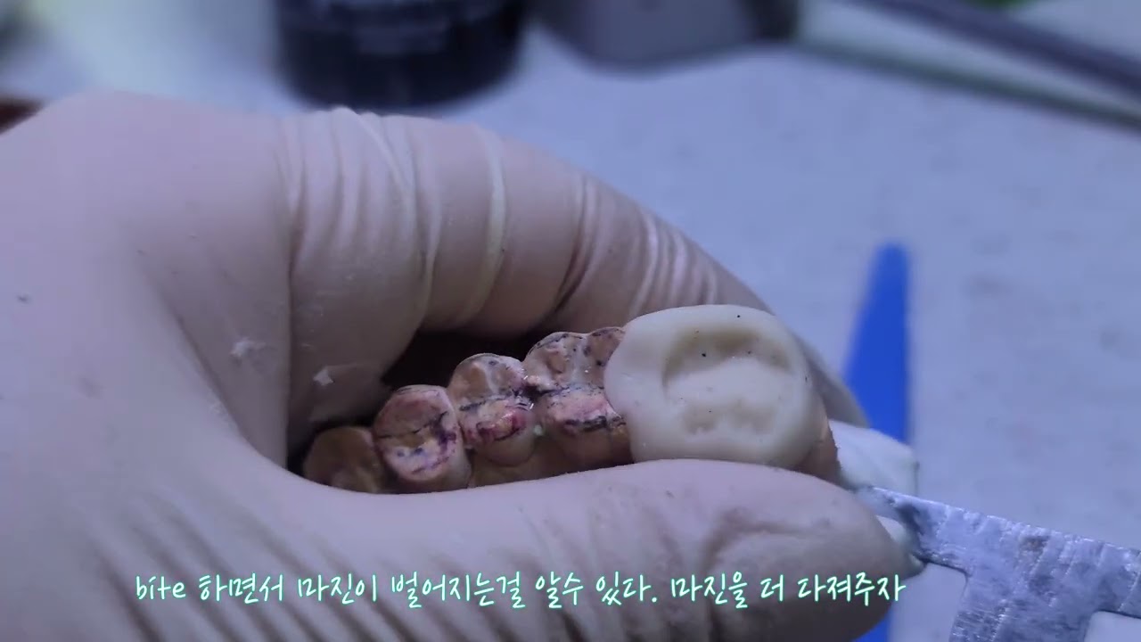 임시치아 믹싱방법